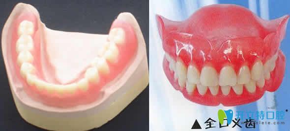 活動假牙圖片
