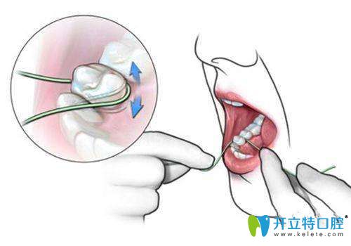 要學(xué)會(huì)使用牙線，保持口腔清潔