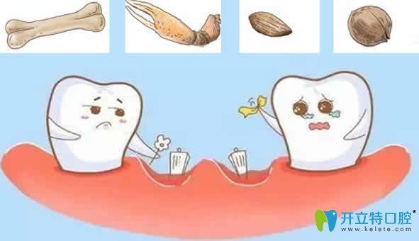 做了種植牙后能咬多硬的東西？有關(guān)種植牙的誤區(qū)看這里
