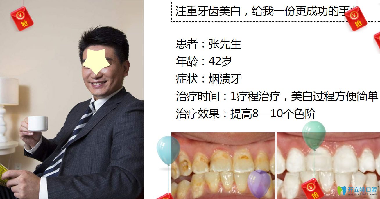 深圳牙齒美白哪里做？格倫菲爾口腔皓齒美白案例公布