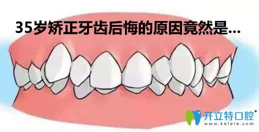 揭秘35歲拔牙矯正后悔死了的內(nèi)幕及35歲矯正牙齒的利與弊