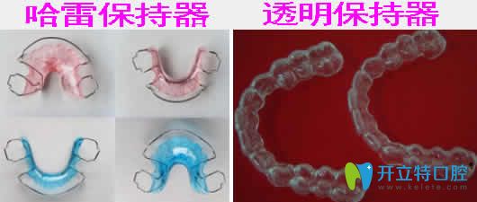 哈雷保持器和透明保持器哪種好？看兩種保持器的優(yōu)勢(shì)區(qū)別