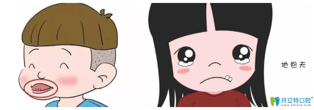 寶寶地包天會自然好嗎，如果矯正該怎么進(jìn)行，效果好不好