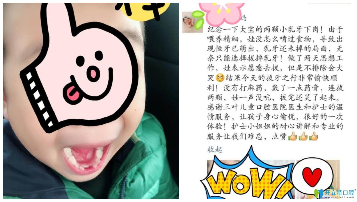 孩子在三葉進(jìn)行治療后家長(zhǎng)點(diǎn)評(píng)