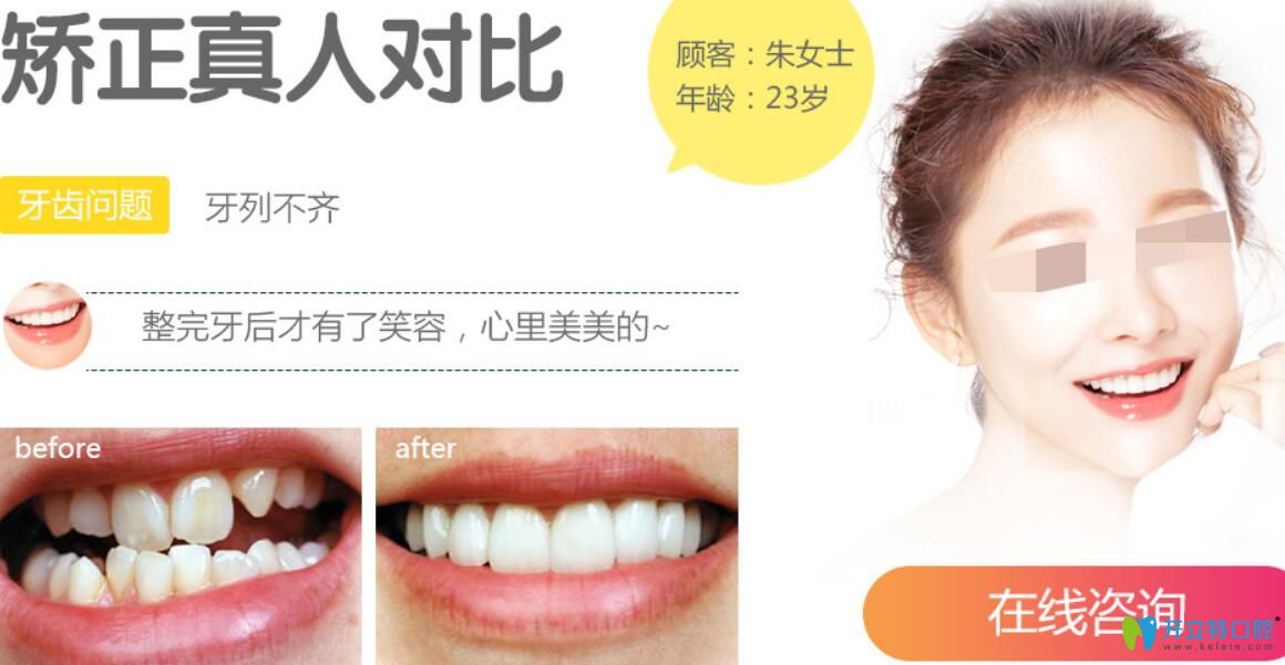 聊城口腔醫(yī)院怎么樣呢？真人牙齒矯正案例效果給你帶來(lái)驚喜