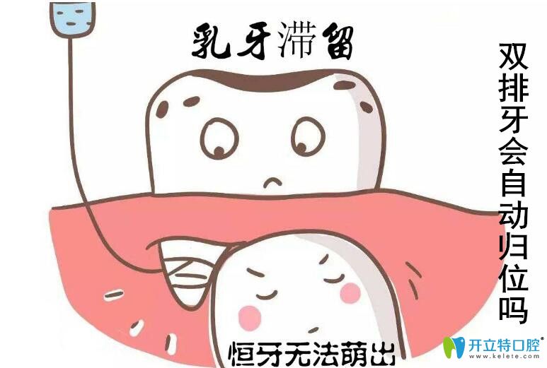 兒童出現(xiàn)了雙排牙怎么辦，會不會自從歸位