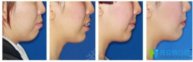 重慶茁悅口腔好不好？真人案例效果見證奇跡