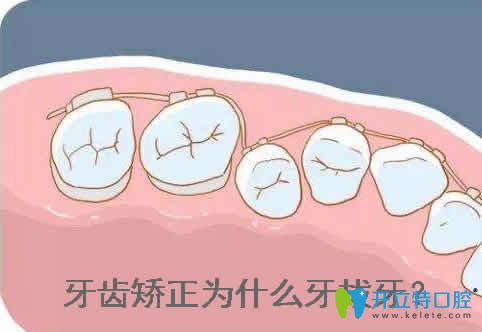 先了解牙齒矯正為什么要拔牙?再看矯正牙齒拔牙有沒(méi)有危害