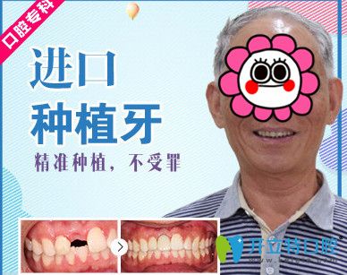 牙大夫與美奧口腔哪個好？美奧口腔種植牙案例來揭曉