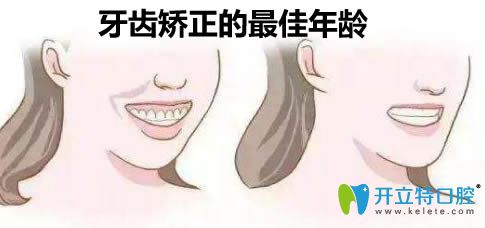 牙齒矯正的年齡