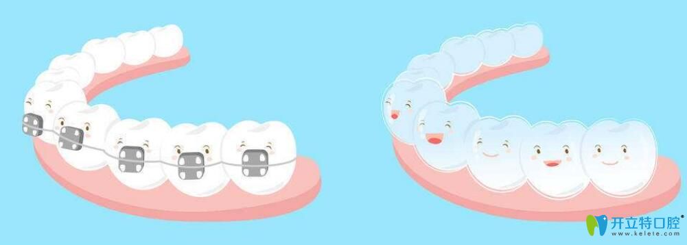 正頜和正畸手術(shù)的區(qū)別？正頜手術(shù)哪里做得好,費(fèi)用是多少？