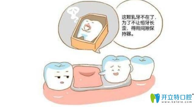 兒童牙齒間隙保持器總是必要的嗎