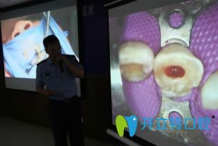 牙髓再生術(shù)的適應(yīng)癥有哪些