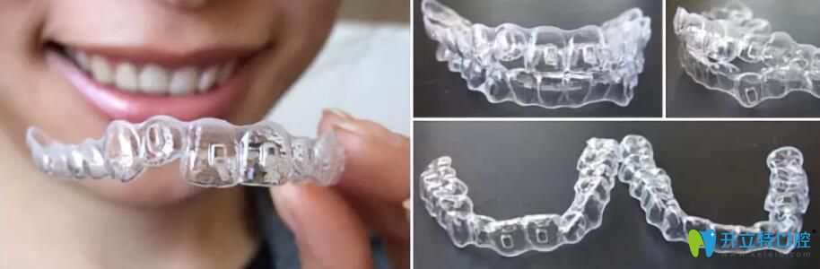 重慶牙博士口腔東方美學矯正+矯牙黑科技優(yōu)勢體現(xiàn)