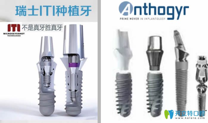 法國(guó)安卓健和瑞士iti種植體實(shí)物圖片