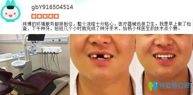 門牙缺失在拜博做完種植牙對比圖