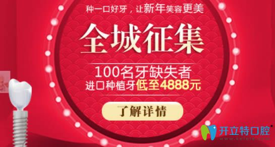上海宏康口腔全城征集100名牙缺失顧客 瑞士iti種植牙僅9888元