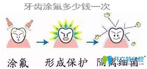專業(yè)解答：小孩牙齒涂氟多少錢以及涂氟防齲有沒有副作用