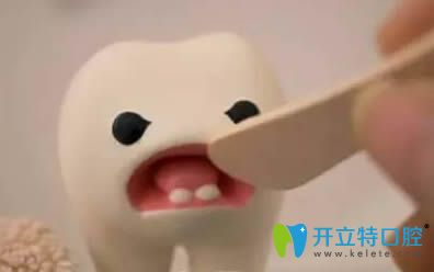 許多牙友以為活髓切斷術(shù)就是根管治療 簡述兩者的區(qū)別對比