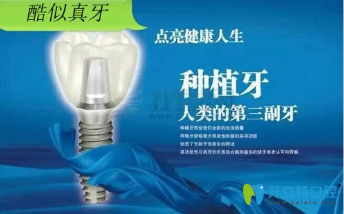 整理的韓國種植牙品牌排行榜中內(nèi)附奧齒泰/登騰等植體價格