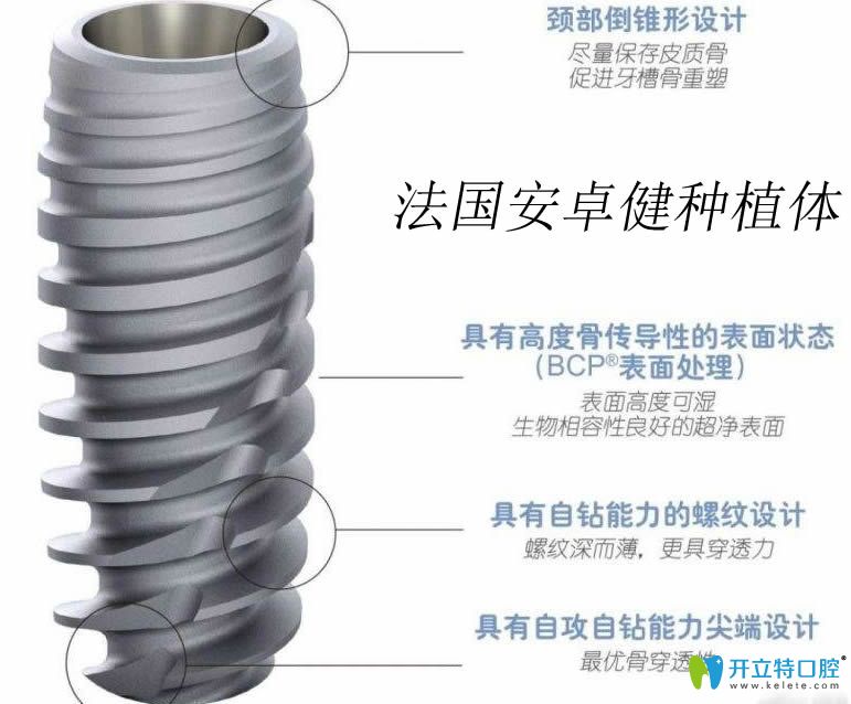 法國安卓健Anthogyr種植體圖
