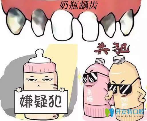 好擔(dān)心奶瓶齲會(huì)影響換牙 那寶寶奶瓶齲齒該怎么治療呢？