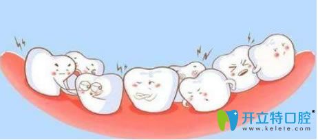 林曦院長(zhǎng)解說做牙齒矯正需要拔牙嗎