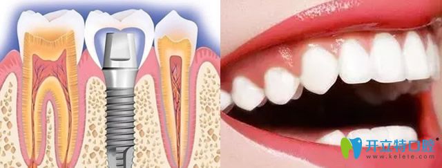 保定合眾口腔牙齒修復+牙齒美白技術優(yōu)勢