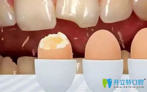 洗牙把牙釉質(zhì)破壞了，聽(tīng)說(shuō)牙釉質(zhì)有再生功能這是真的嗎？