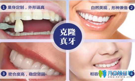 美容冠牙齒優(yōu)點