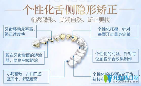 舌側矯正具有矯正速度快等優(yōu)勢