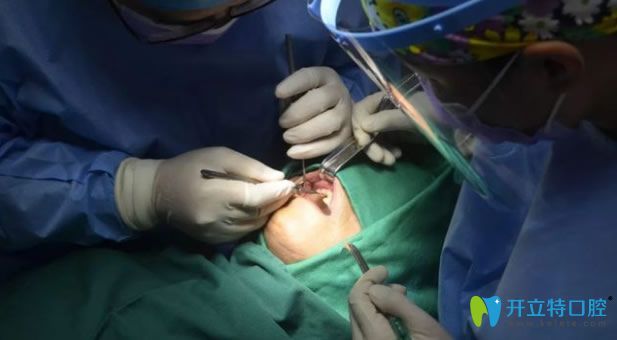 寧波牙博士口腔王道軍醫(yī)生給老爸做種植牙手術(shù)中 寧波牙博士口腔王道軍醫(yī)生給老爸做種植牙手術(shù)中