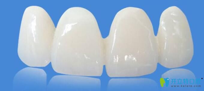 鑄瓷牙是全瓷牙嗎？鑄瓷牙和全瓷牙到底有什么區(qū)別？