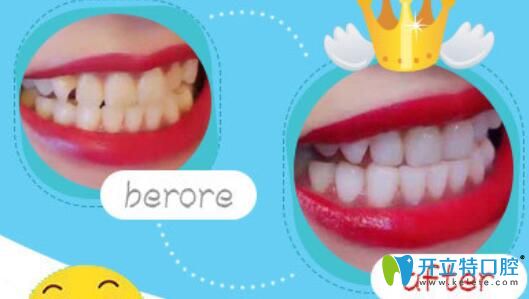 南京博韻口腔丁冬梅怎么樣？案例驗(yàn)證實(shí)力