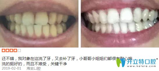 淄博海全口腔潔牙案例效果圖