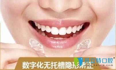 無(wú)托槽隱形牙套圖片