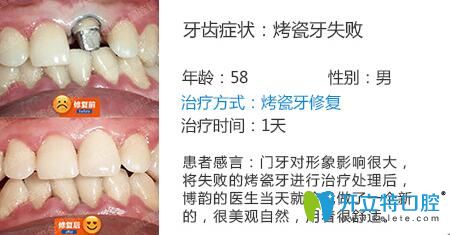 醫(yī)生姓名：周光正   醫(yī)生資質(zhì)：全科醫(yī)生  所屬機(jī)構(gòu)：南京博韻口腔  社會任職：  畢業(yè)院校：畢業(yè)于邢臺<!--<i data=20240703-sp></i>-->口腔醫(yī)學(xué)系  主診項目：牙列缺損修復(fù)、口腔種植、前牙美學(xué)修復(fù)、嵌體修復(fù)及復(fù)雜牙拔除。