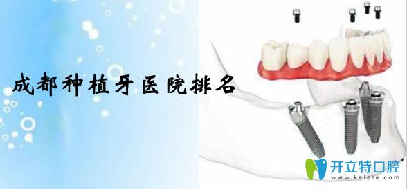 今天公布成都種植牙價(jià)格表及成都種植牙醫(yī)院排名情況