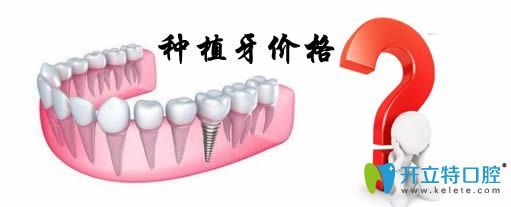 通過重慶種植牙價(jià)格表來揭秘重慶種植牙多少錢一顆？
