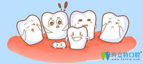 阻生牙拔不拔竟然和阻生牙的種類(lèi)有關(guān)