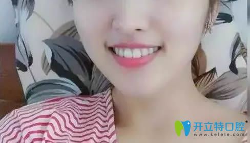 在南陽(yáng)澤康口腔做牙齒矯正歷程體會(huì)：很麻煩但值得！