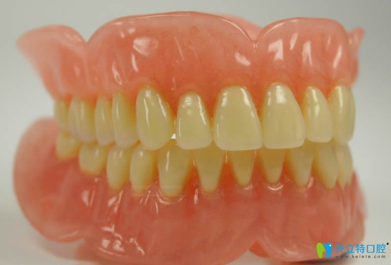 內(nèi)行人解析日本松風(fēng)塑鋼牙的價(jià)格需要多少錢(qián)?質(zhì)量好不好？