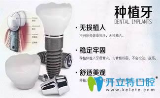 沈陽(yáng)歡樂(lè)口腔科普種植牙的適應(yīng)人群及參考價(jià)格