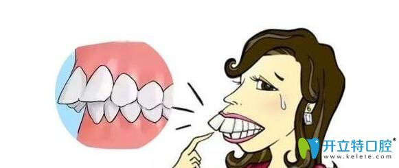 做過(guò)掩飾性正畸可以正頜嗎？真人經(jīng)驗(yàn)分享