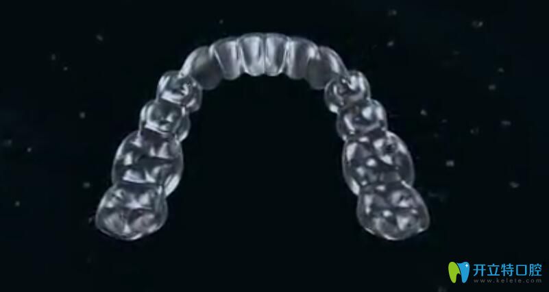 時(shí)代天使隱形牙套