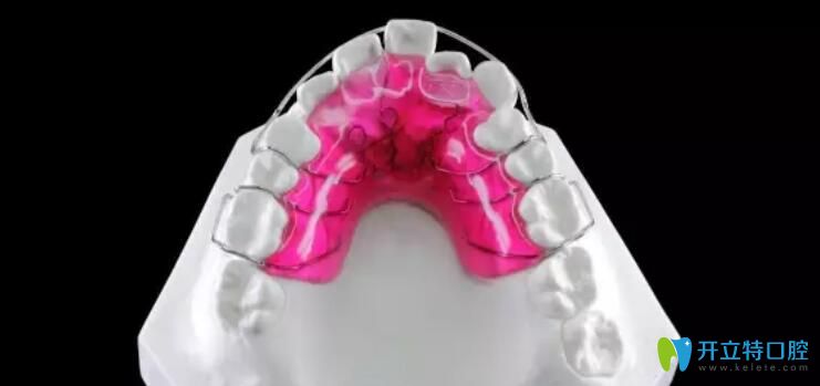 活動矯正器優(yōu)缺點(diǎn)