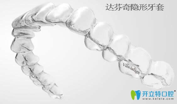 國產(chǎn)達(dá)芬奇隱形牙套