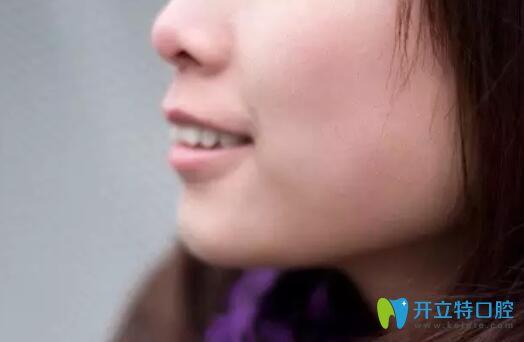 在鄭州德正口腔矯正齙牙雖然沒拔牙，但正畸效果還合我意