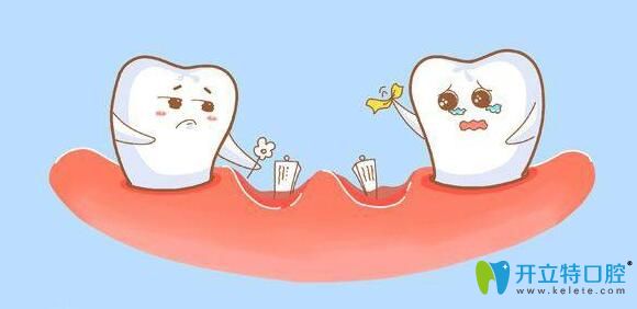 連保強(qiáng)科普：牙齒缺失有什么影響