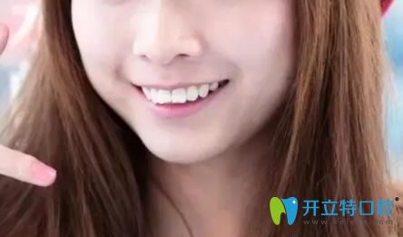 齙牙矯正前正面照